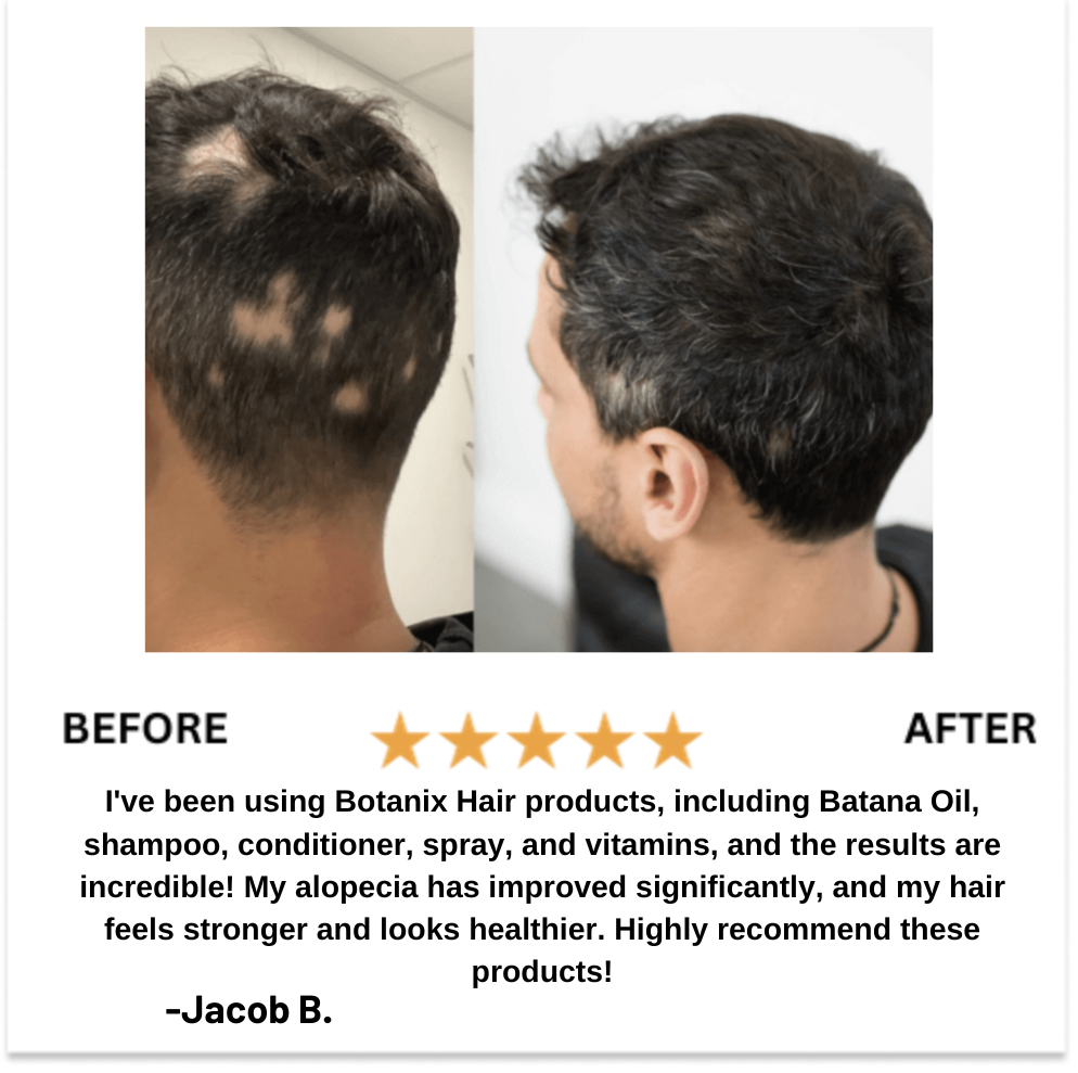 30 Day Hair Growth Challenge